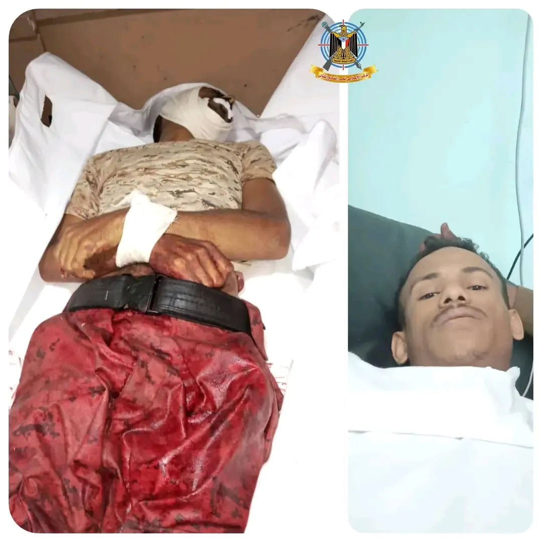 الضالع: القوات الجنوبية تحبط هجومًا حوثيًا شرسًا وتكبده خسائر كبيرة، فيما ارتقى شهيد وأصيب آخر من ابطالها